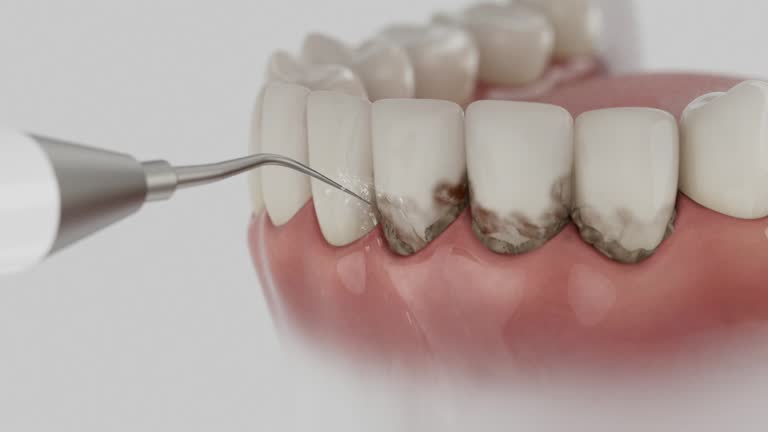 Trusted Tooth Extraction service in Charleston, WV - Dentist Open Now